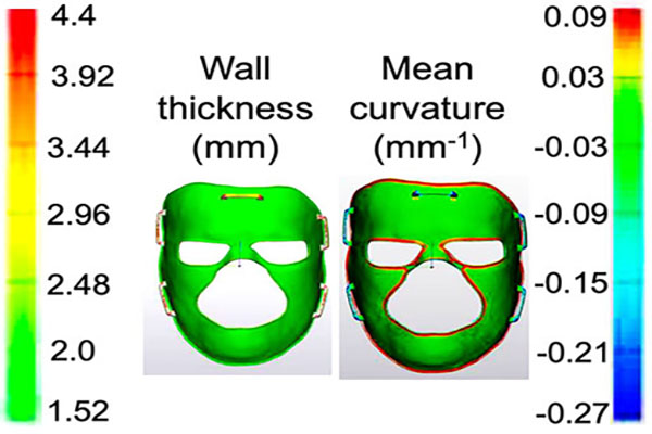 Surface deviation map of the internal surface of a transparent orthosis.