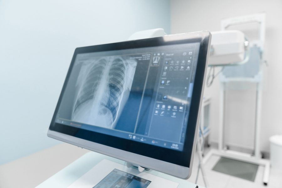 Close up of x-ray image of human chest lungs shown on the monitor screen modern laboratory equipment computer.