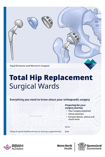 Total Hip Replacement – Surgical Wards Total Hip Replacement - Surgical Wards