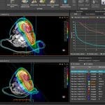 RBWH Radiation Therapy Cancer Care welcomes RayStation