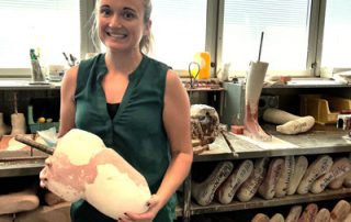 RBWH Orthotic and Prosthetic Team Leader Jessica Angus