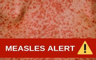 Measles Alert feature image