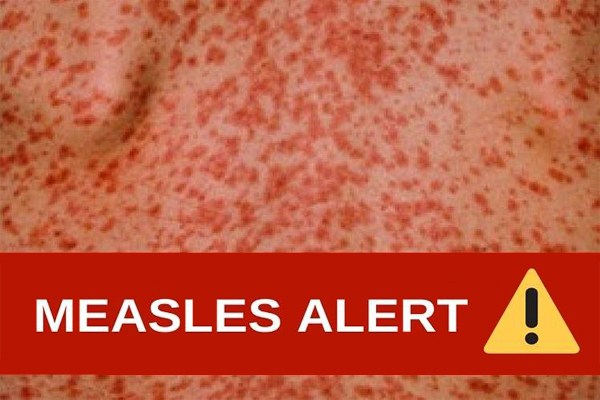 Measles Alert feature image
