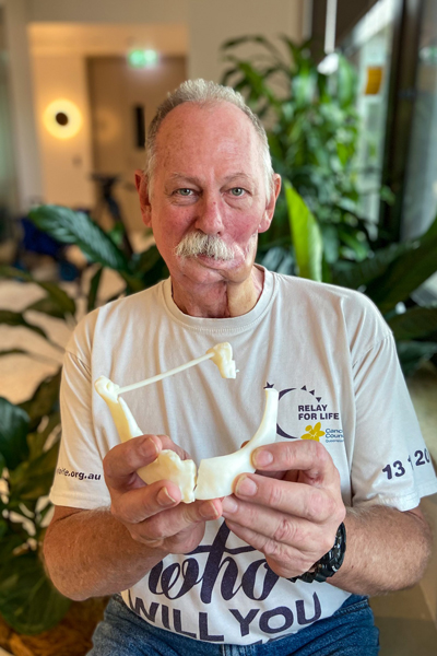 John Manwaring is regrowing his own jawbone thanks to the Herston Biofabrication Institute, the RBWH plastics team and Singaporean company Osteopore.