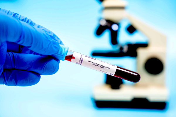 Elevated Blood-lead Elevated Blood-lead